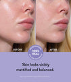 A side by side image of someone before and after using facial serum for oily skin, with the skin in the after image visibly more matte and balanced, particularly on the chin, cheeks, and around the nose