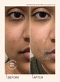A before and after comparison of someone using Travel Size Glass Skin Refining Serum where the after image clearly shows the blemishes are visibly reduced and the skin looks more hydrated and radiant after two weeks