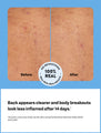 A before and after of Peach Slices’s new skin care for pimples effectiveness, showing a whitehead in the before image, and an after with the whitehead cleared out