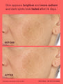  A before and after of Peach and Lily’s new vitamin C moisturizer effectiveness, showing a patch of skin treated with Transparen-C Pro Brightening Moisturizer, where the after clearly shows dark spots having lightened