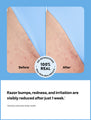 A before and after of Peach Slices’s new skin care for pimples effectiveness, showing red spots on someone’s arm in the before image and the after where the targeted spots have calmed